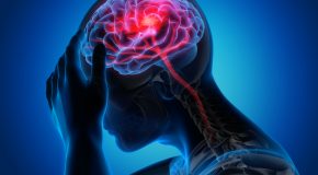 Accident vasculaire cérébral – Plus de séquelles chez les patients défavorisés